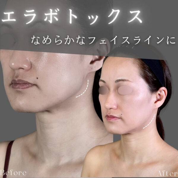 No.8692の症例写真