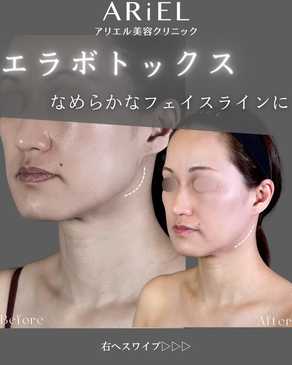 No.8692の症例写真