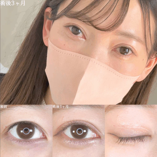 No.8669の症例写真