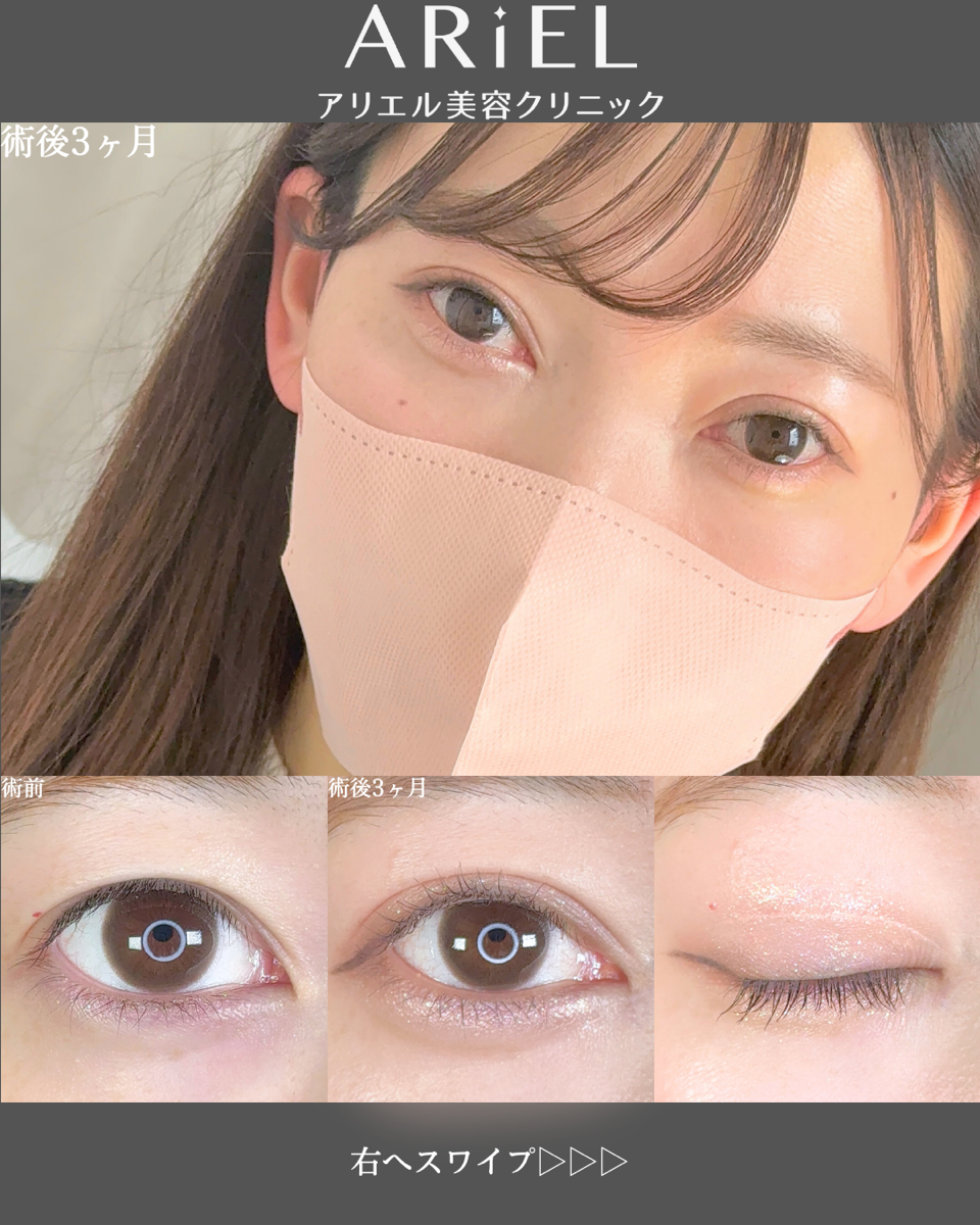 No.8669の症例写真 No.8669の症例写真