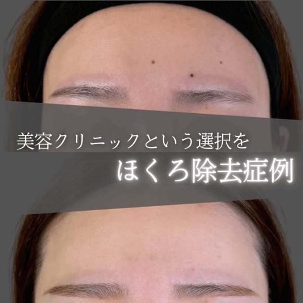 No.8911の症例写真