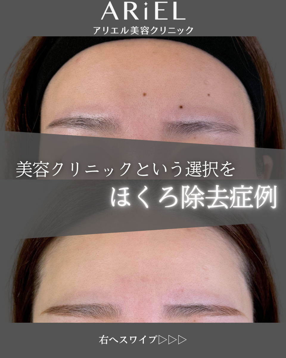 No.8911の症例写真 No.8911の症例写真