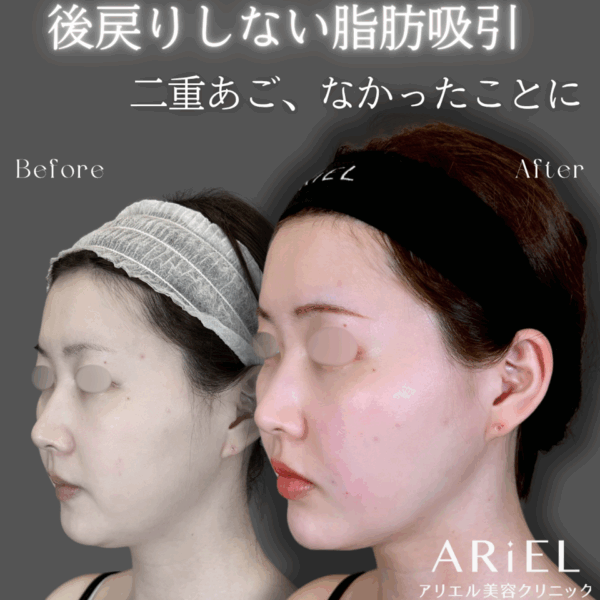 No.9148の症例写真