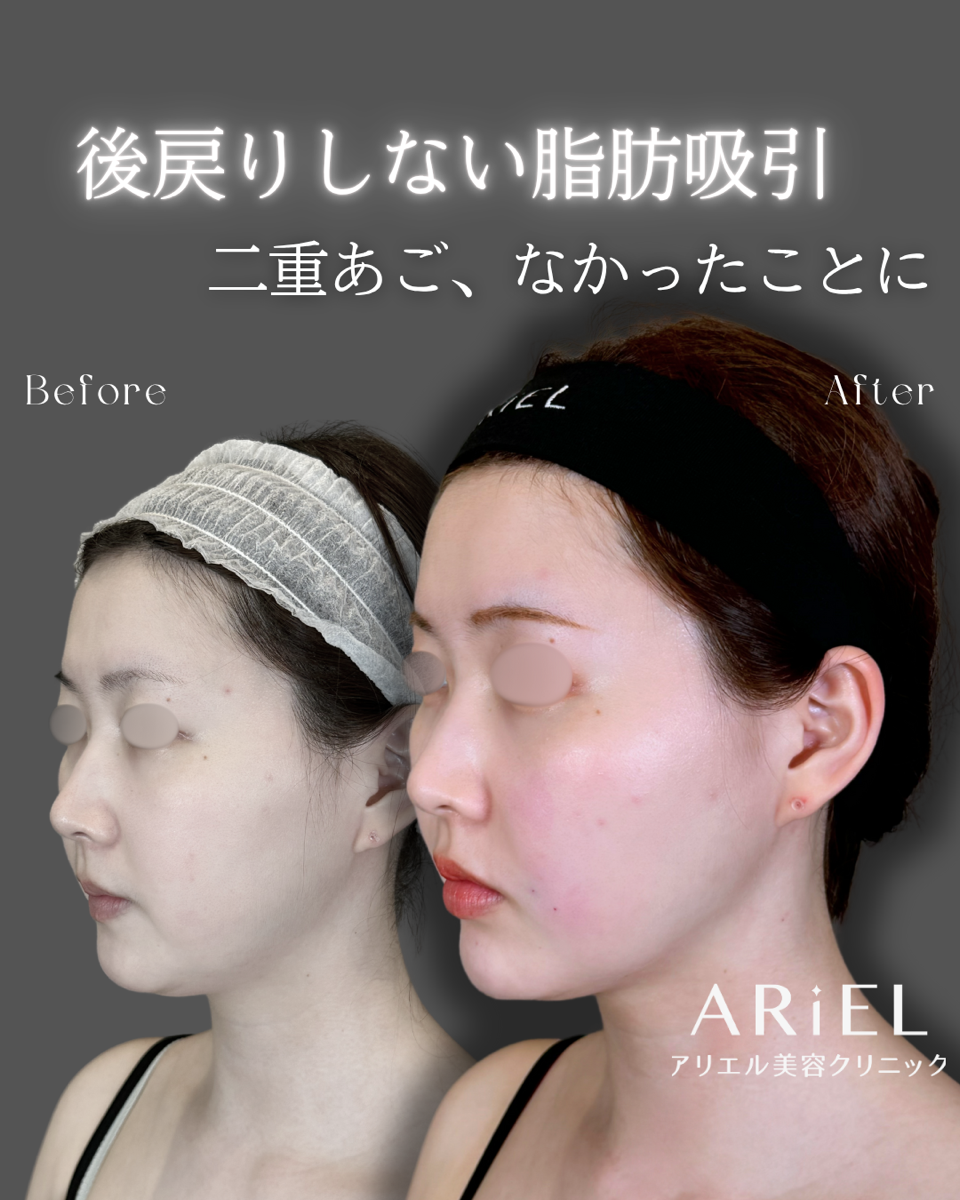 No.9148の症例写真 No.9148の症例写真