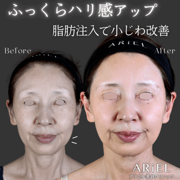 No.9258の症例写真