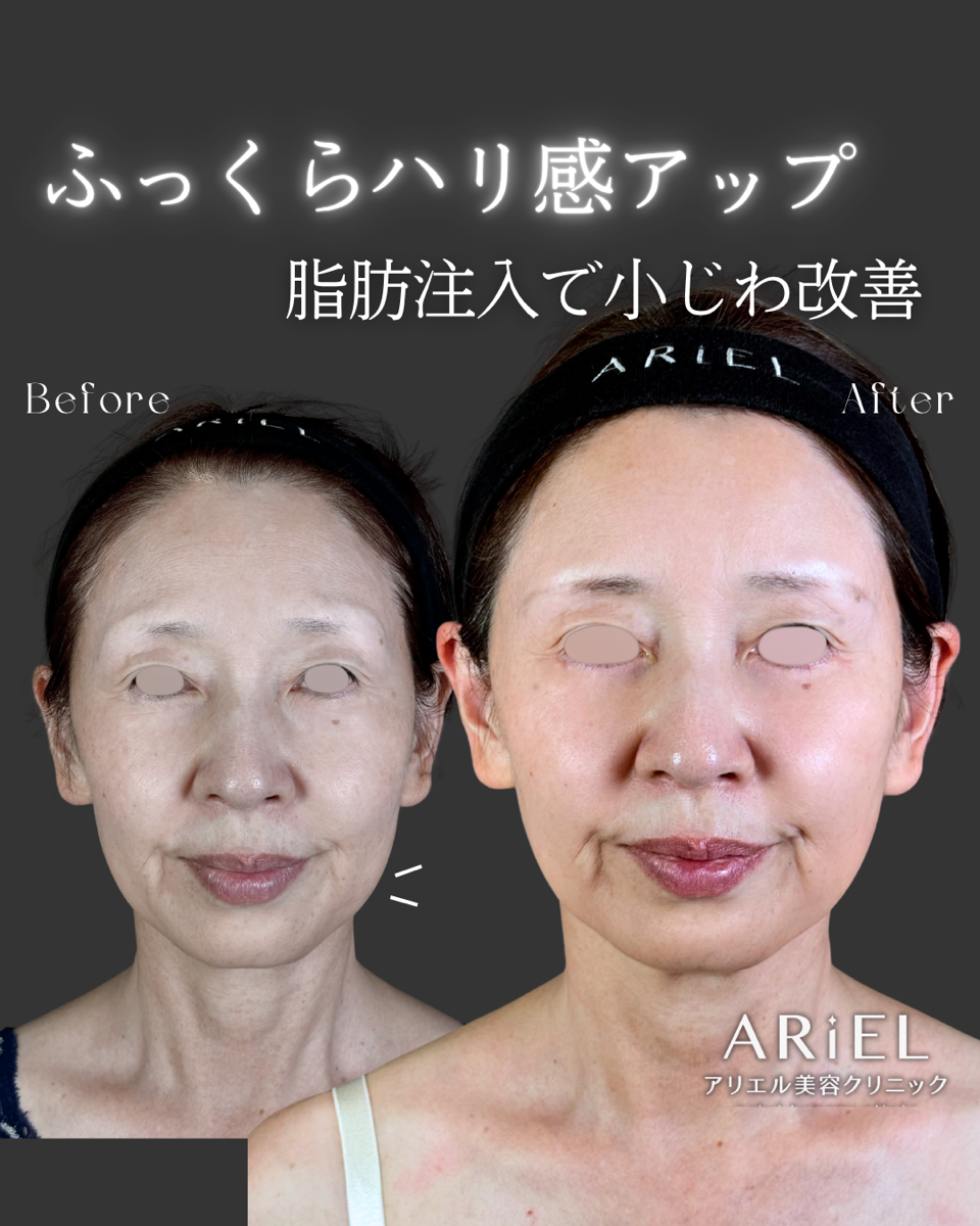 No.9258の症例写真 No.9258の症例写真