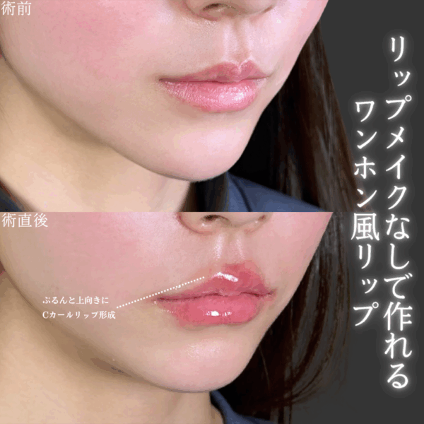 No.9244の症例写真