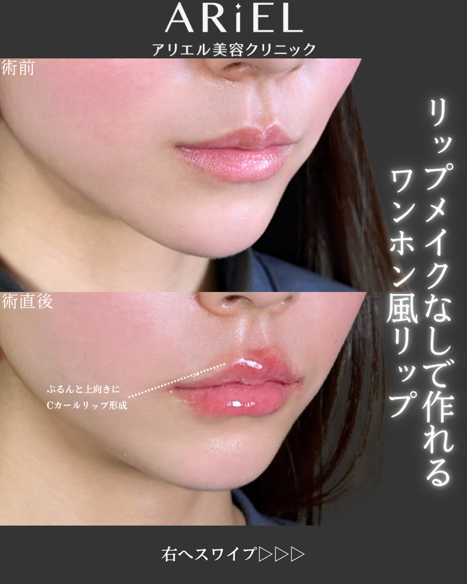 No.9244の症例写真