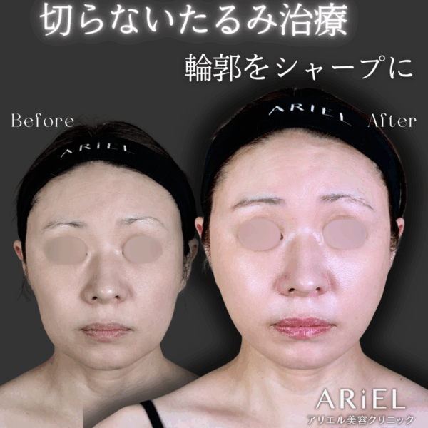 No.9391の症例写真