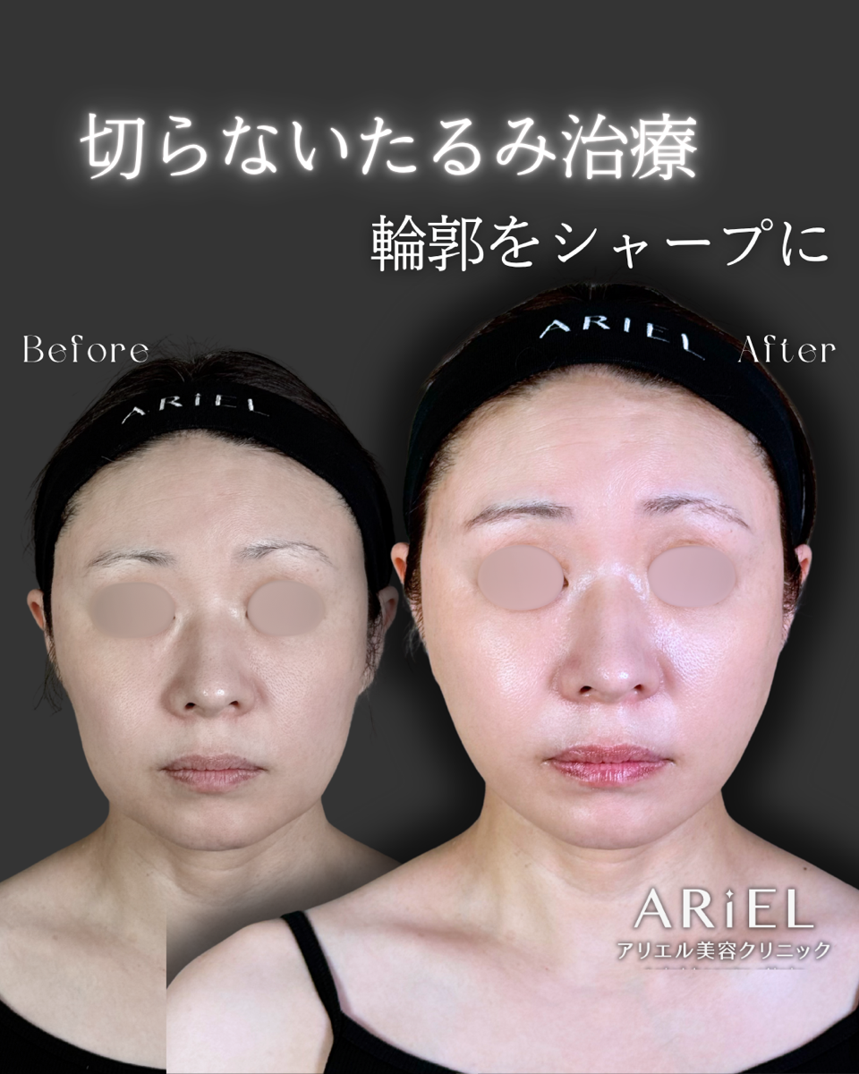 No.9391の症例写真 No.9391の症例写真