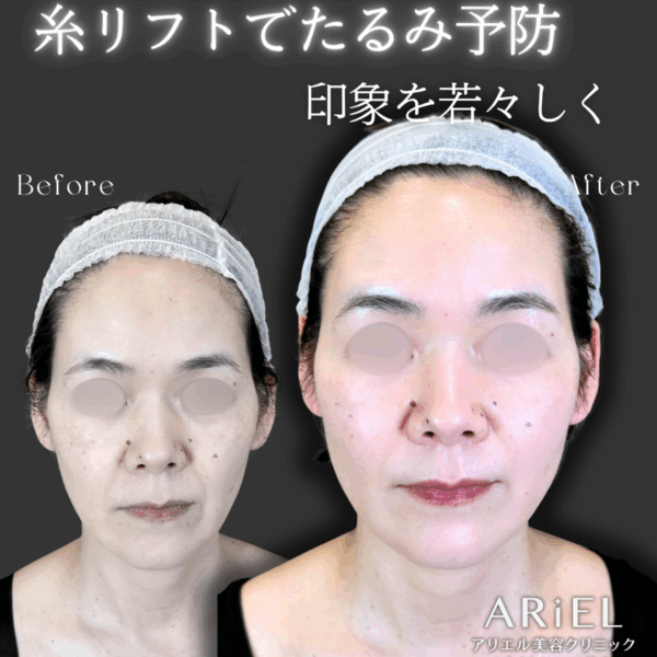 No.9508の症例写真