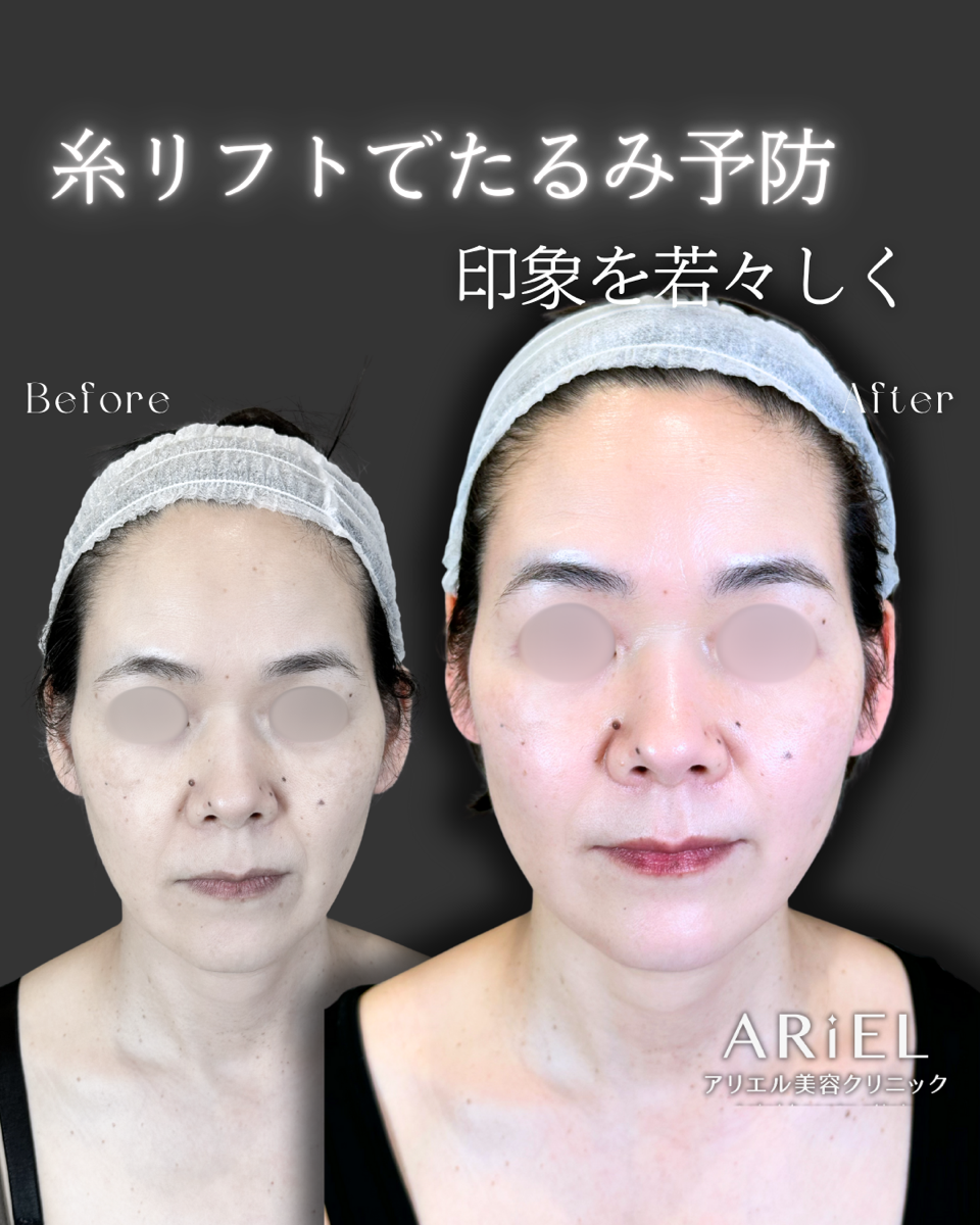 No.9508の症例写真