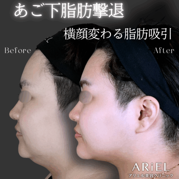 No.9406の症例写真
