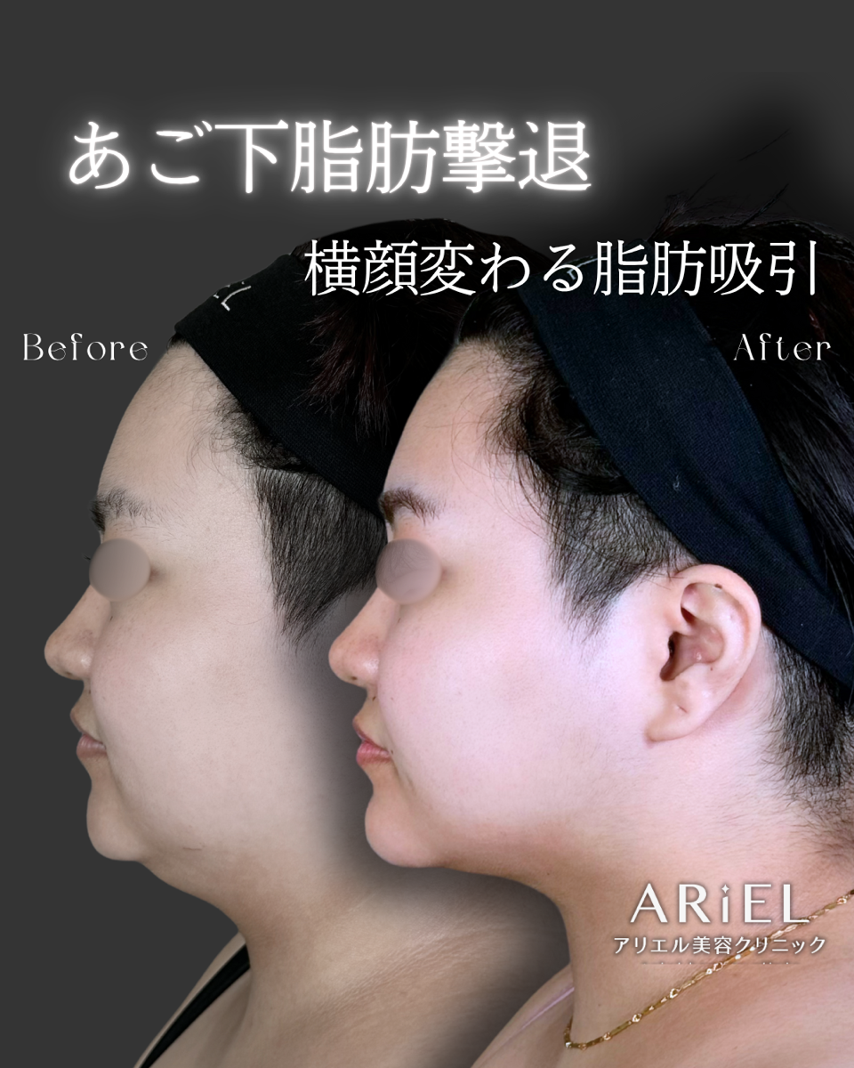 No.9406の症例写真