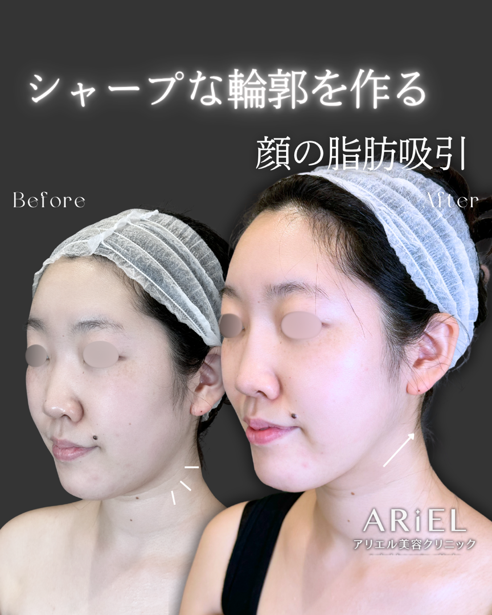 No.9515の症例写真