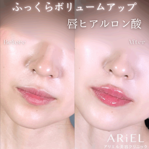 No.9578の症例写真