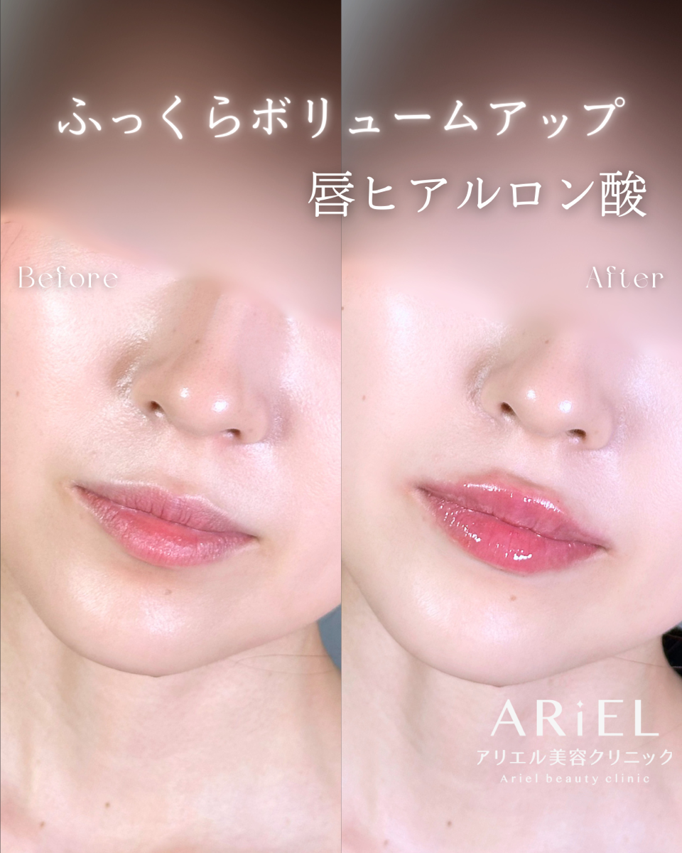 No.9578の症例写真 No.9578の症例写真