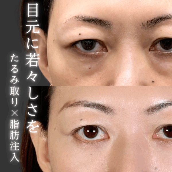 No.9584の症例写真