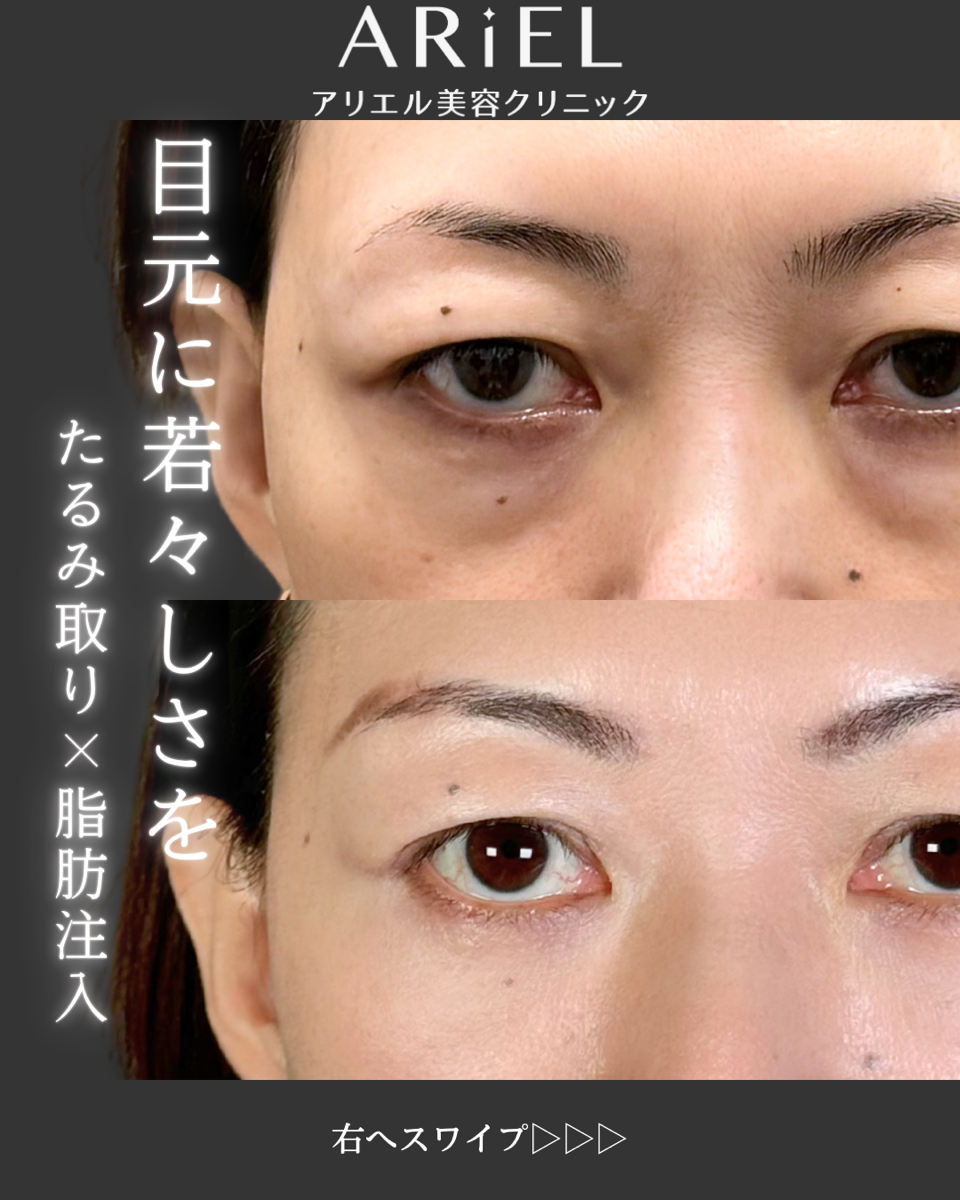 No.9584の症例写真 No.9584の症例写真