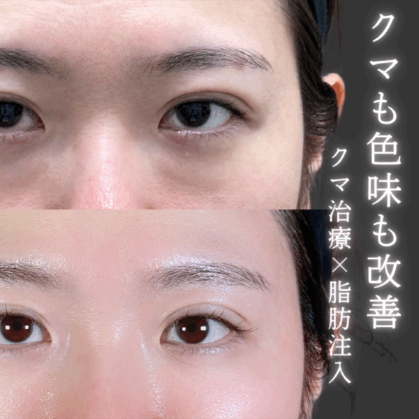 No.9558の症例写真