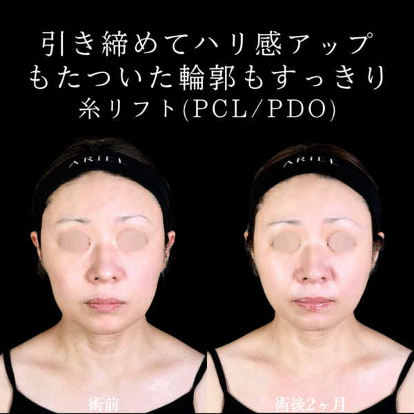No.9820の症例写真