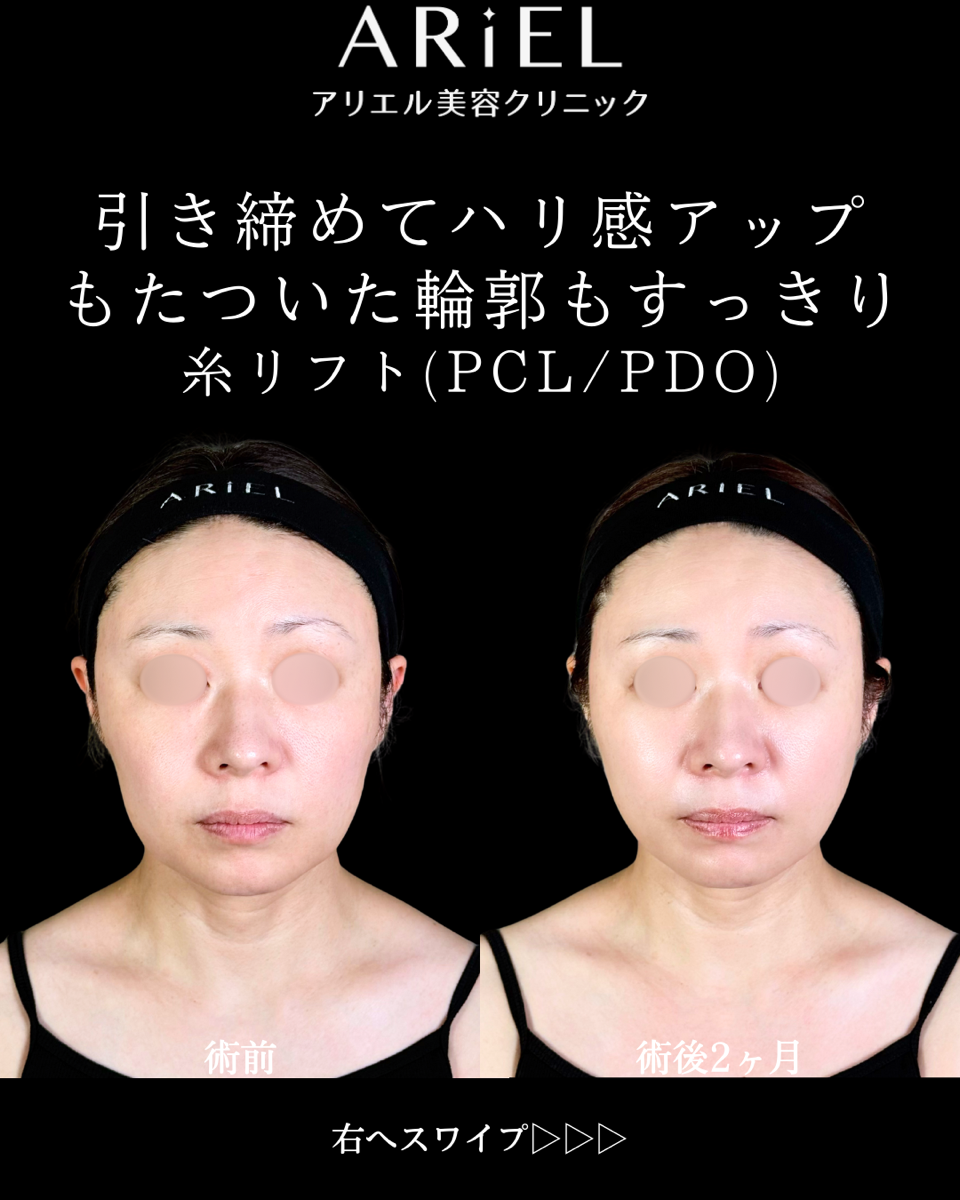 No.9820の症例写真 No.9820の症例写真