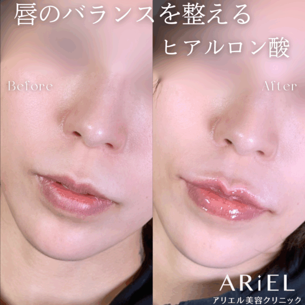 No.9754の症例写真