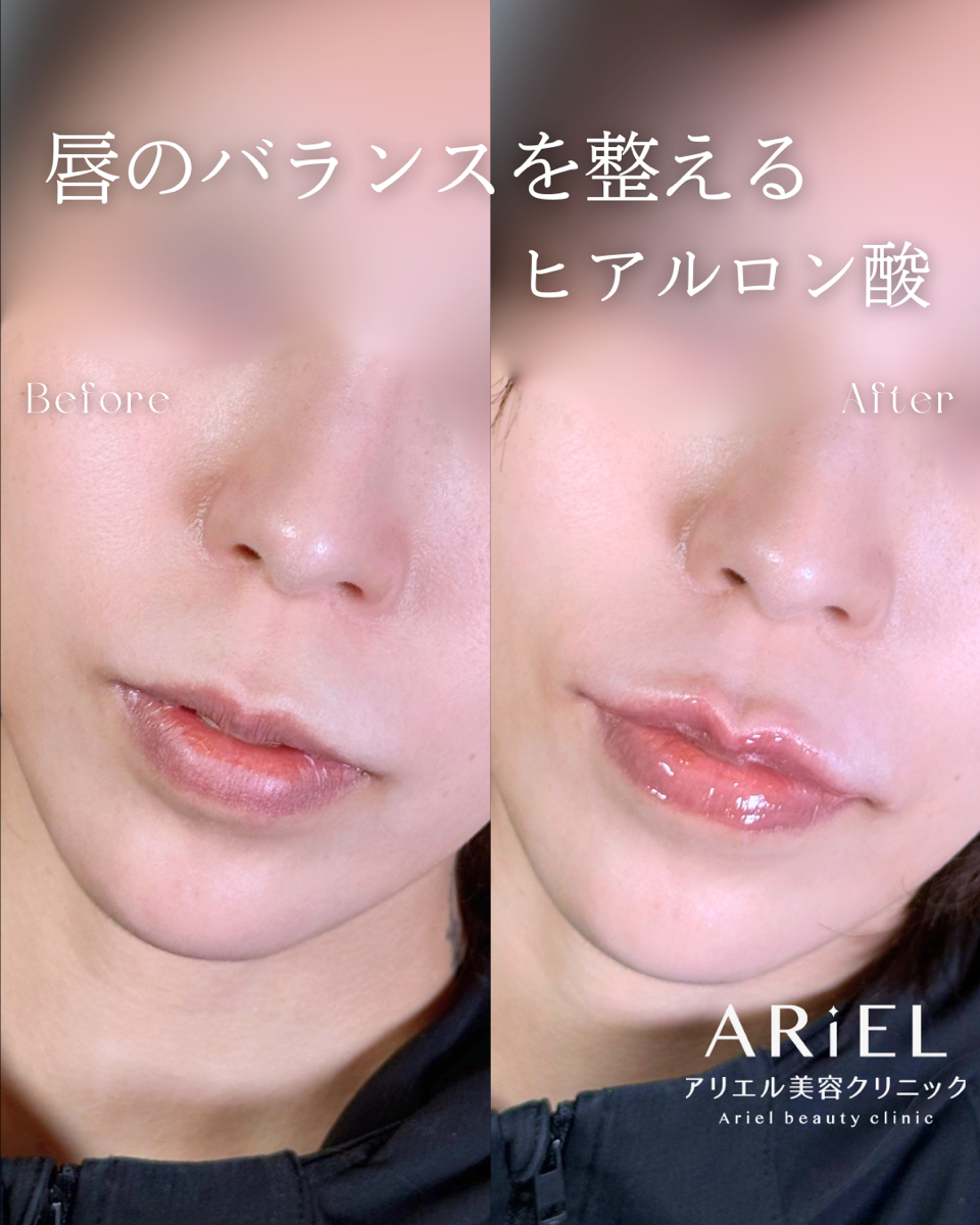 No.9754の症例写真 No.9754の症例写真