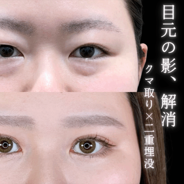 No.9776の症例写真
