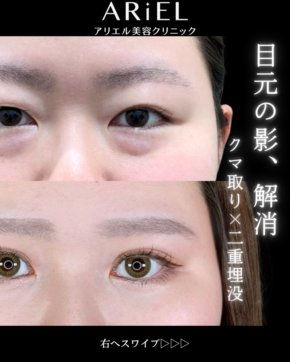 No.9776の症例写真 No.9776の症例写真