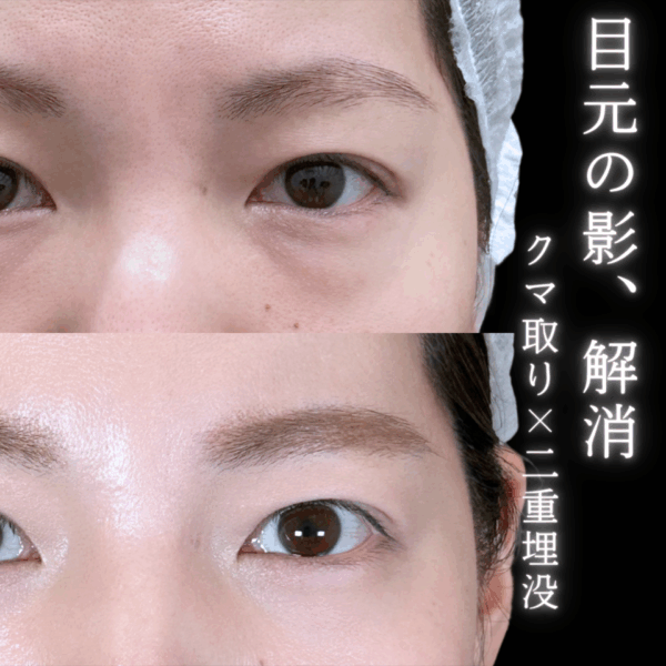 No.9762の症例写真