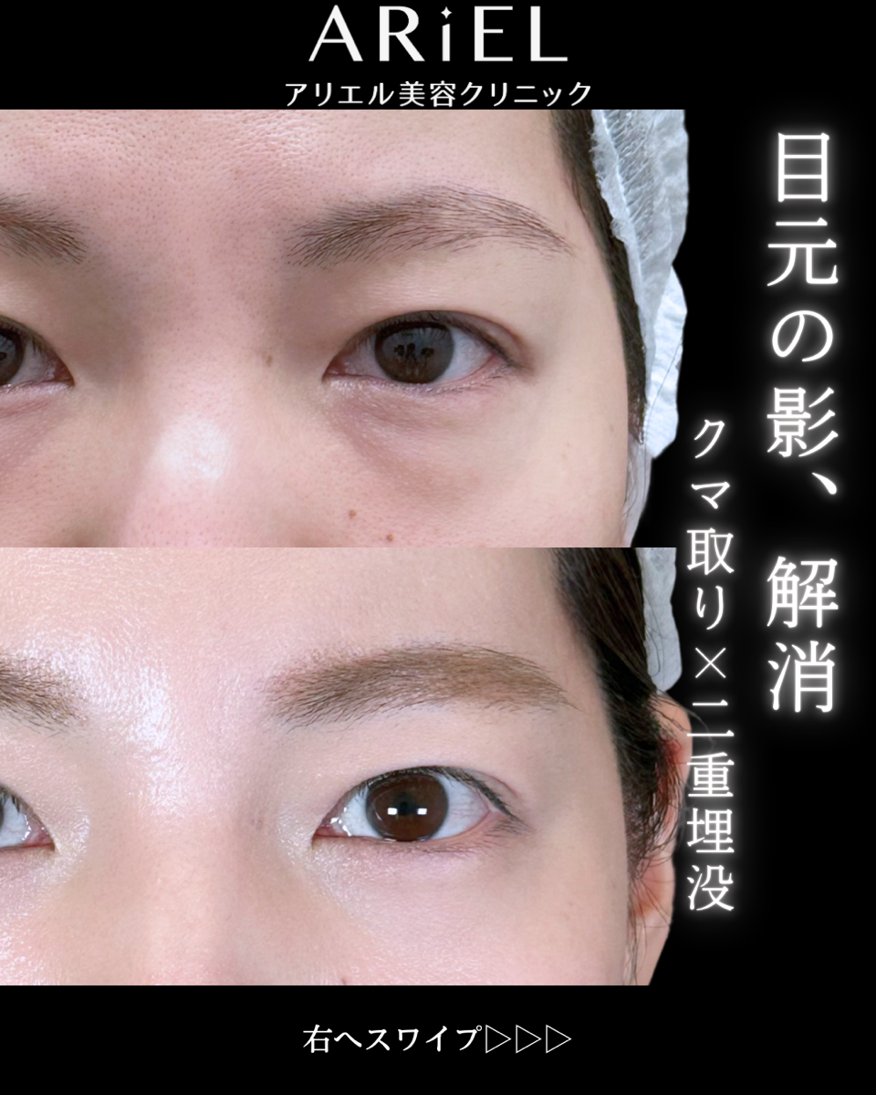 No.9762の症例写真 No.9762の症例写真