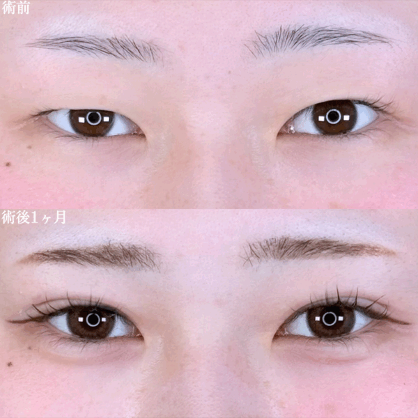 No.9769の症例写真