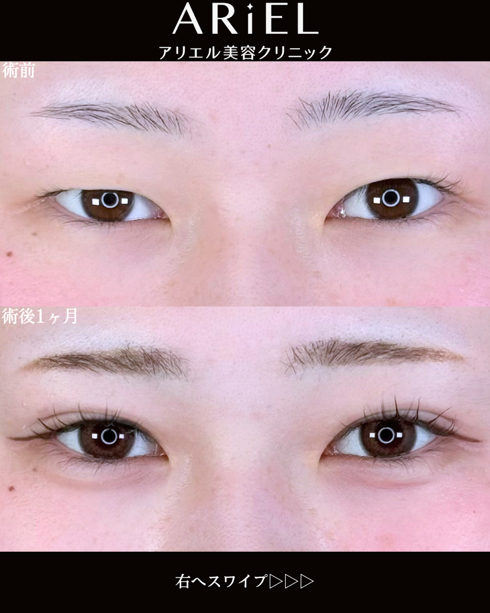 No.9769の症例写真 No.9769の症例写真