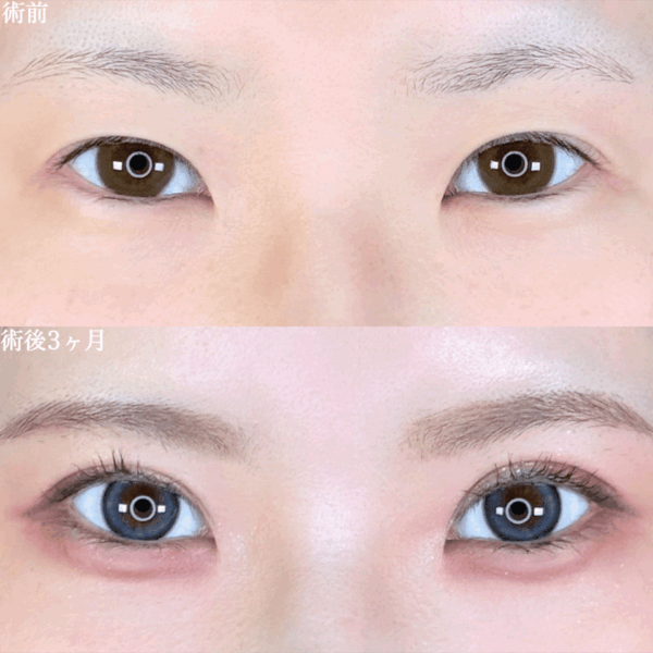 No.9552の症例写真