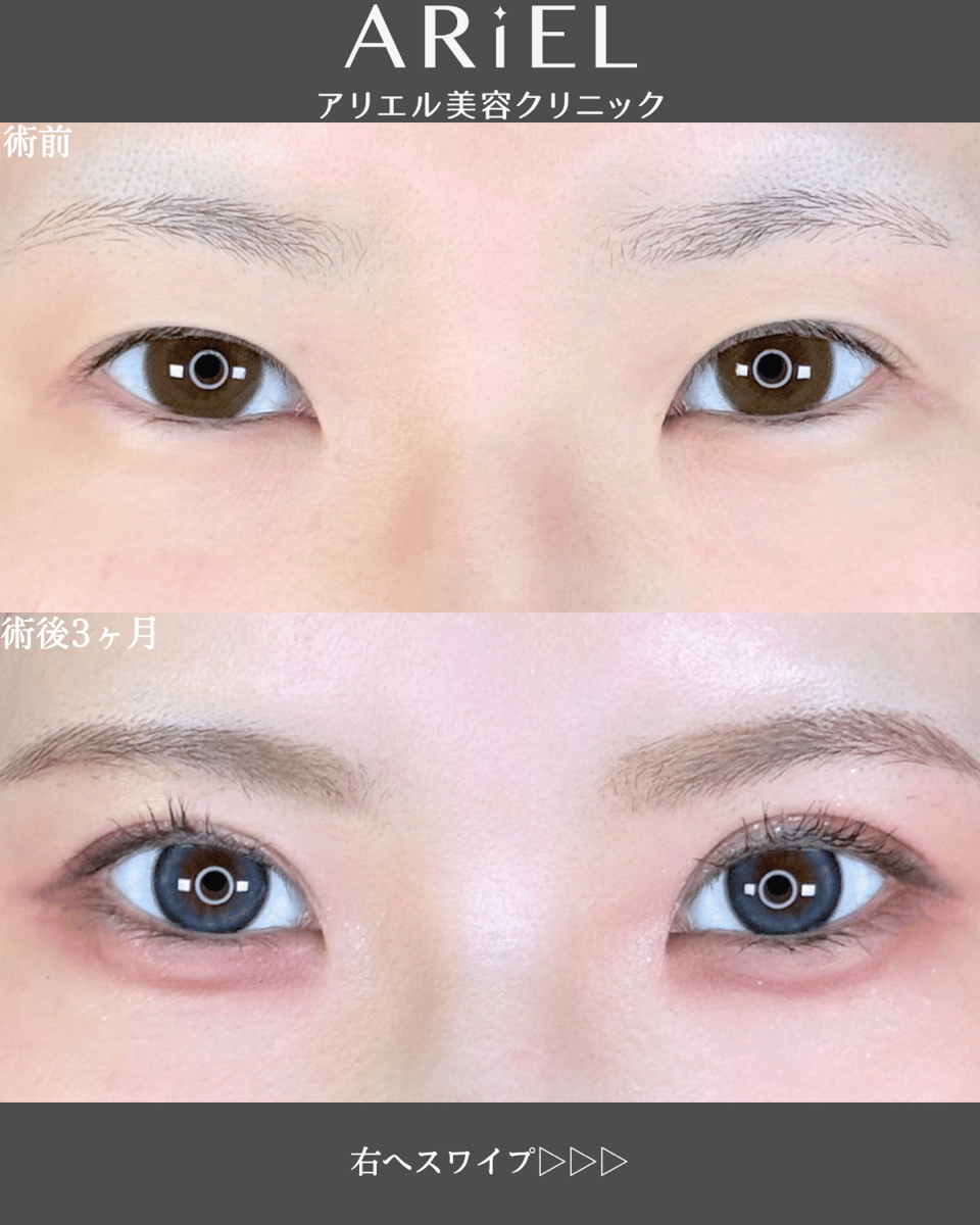 No.9552の症例写真 No.9552の症例写真