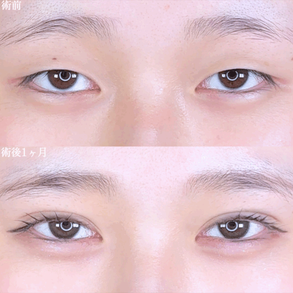 No.9813の症例写真