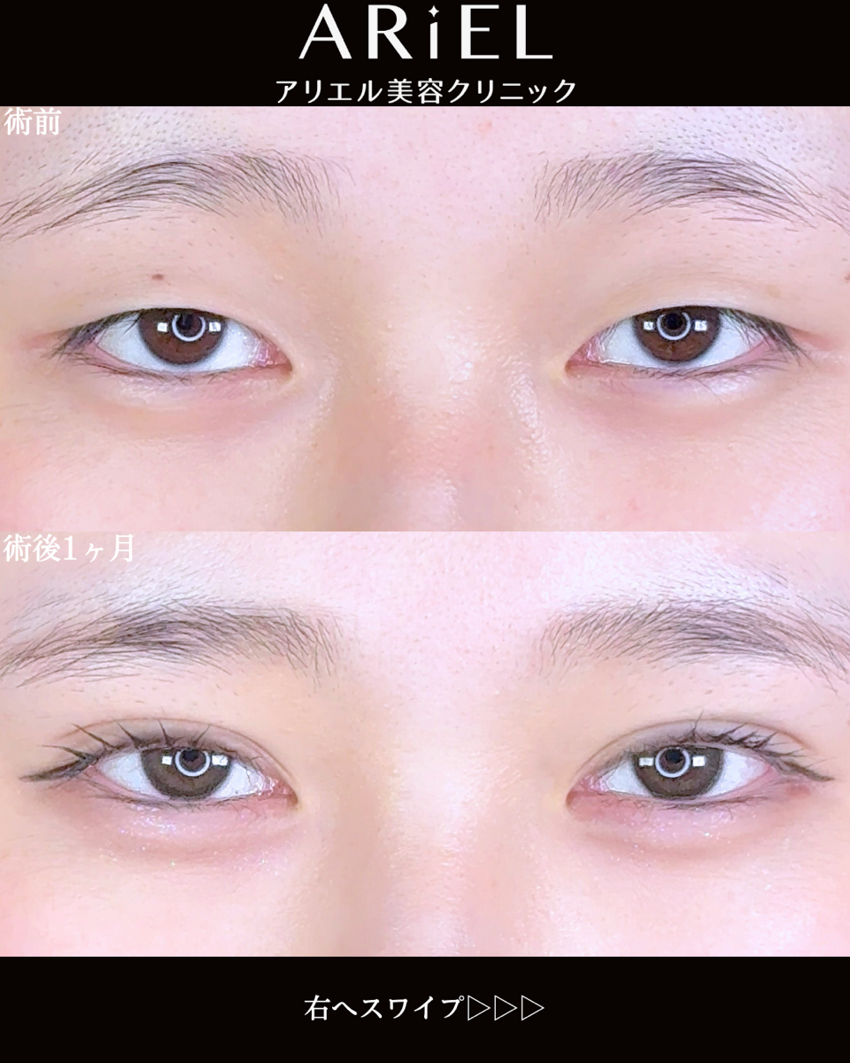 No.9813の症例写真 No.9813の症例写真