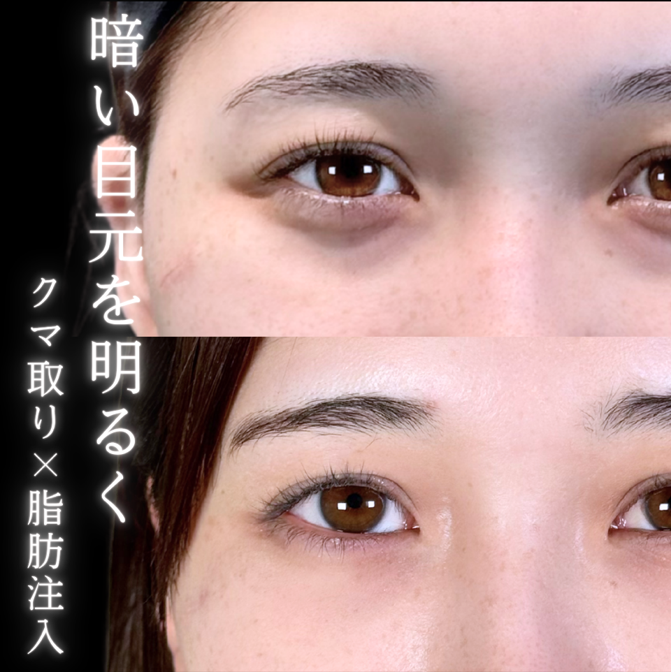 No.9884の症例写真