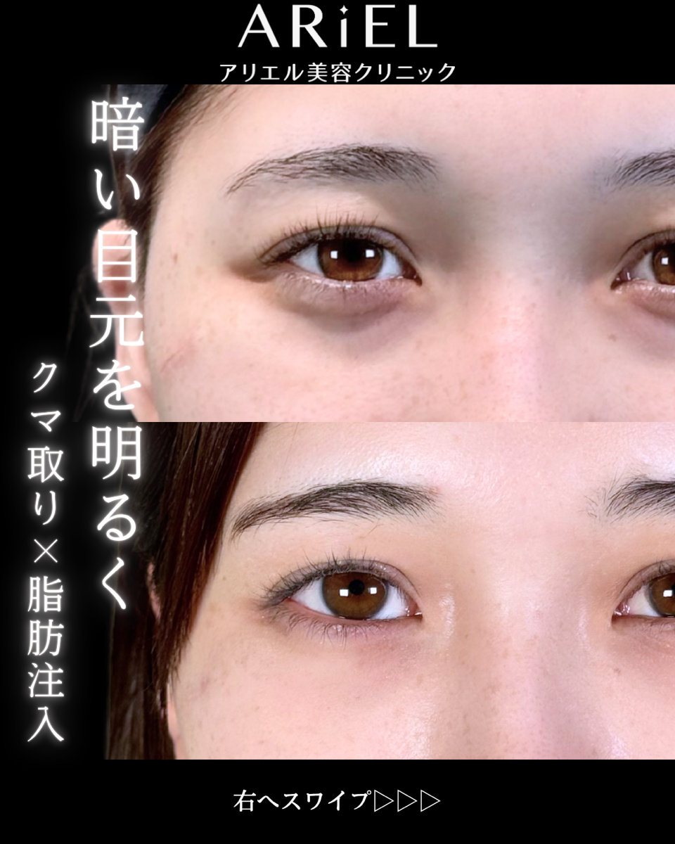 No.9884の症例写真 No.9884の症例写真