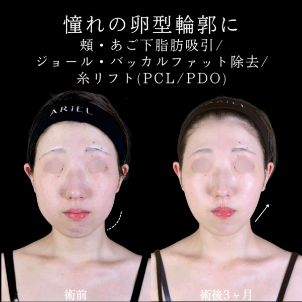 No.9844の症例写真