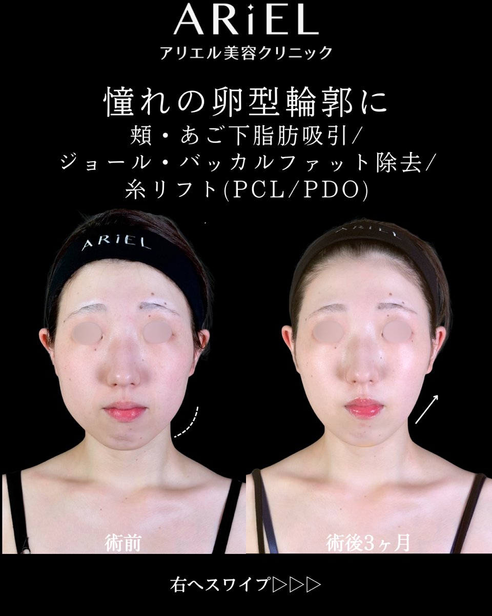 No.9844の症例写真 No.9844の症例写真