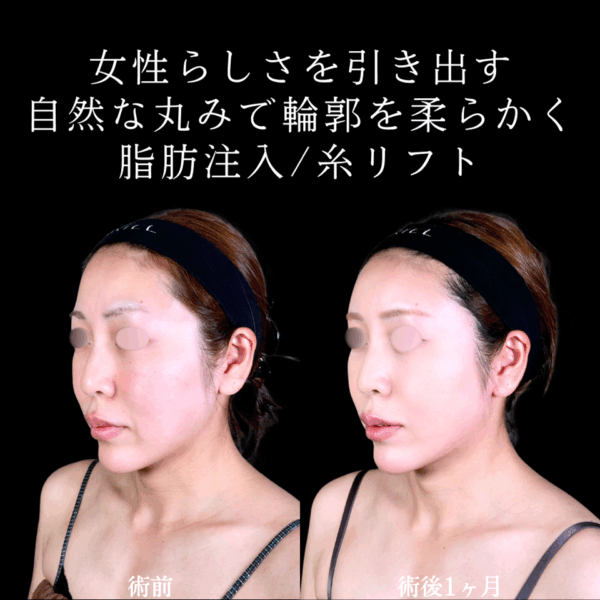 No.9850の症例写真