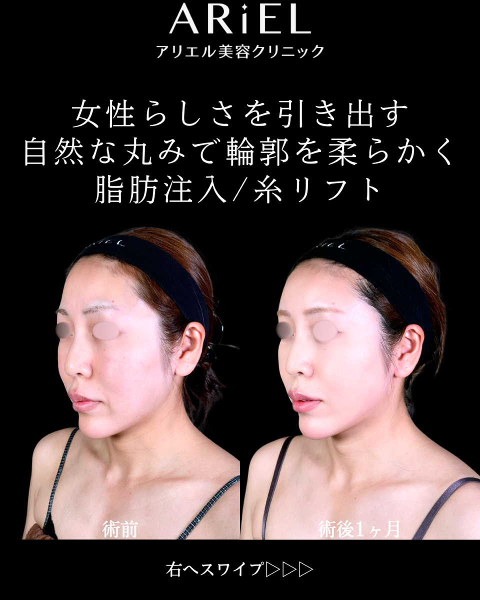 No.9850の症例写真 No.9850の症例写真