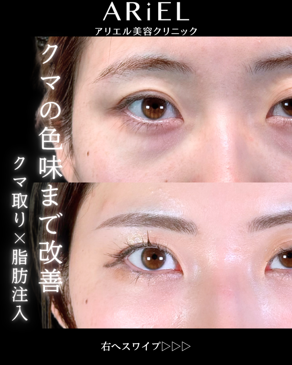 No.9870の症例写真 No.9870の症例写真