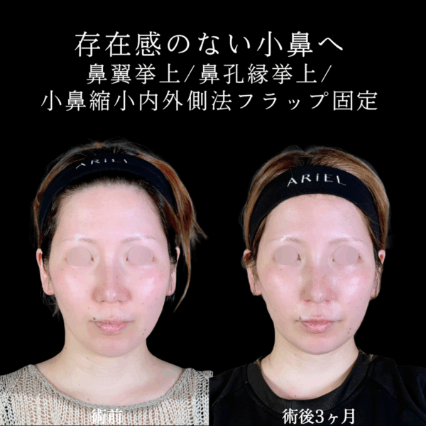 No.9864の症例写真