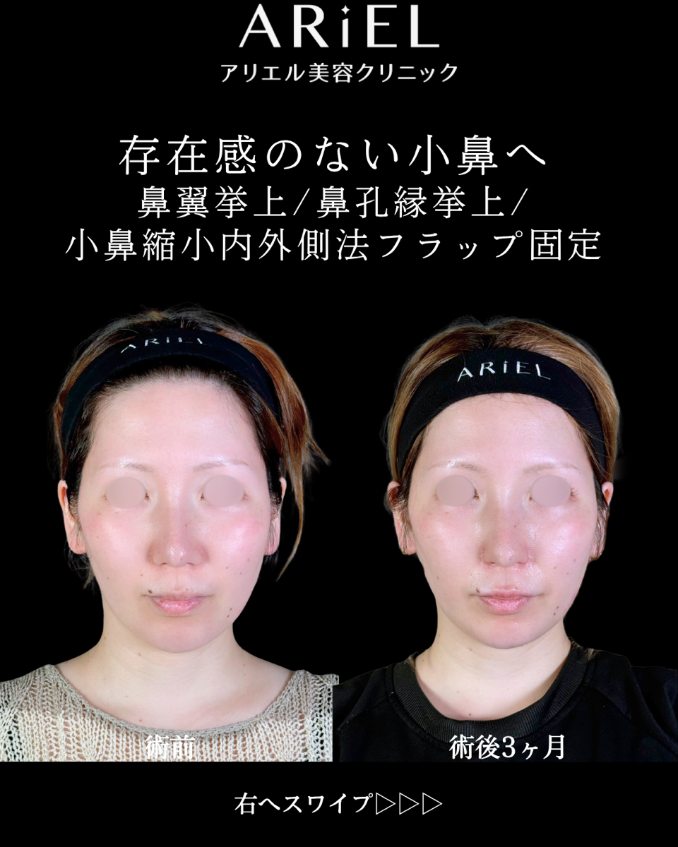 No.9864の症例写真 No.9864の症例写真