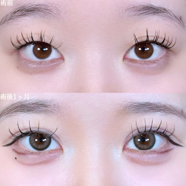 No.9894の症例写真 No.9894の症例写真