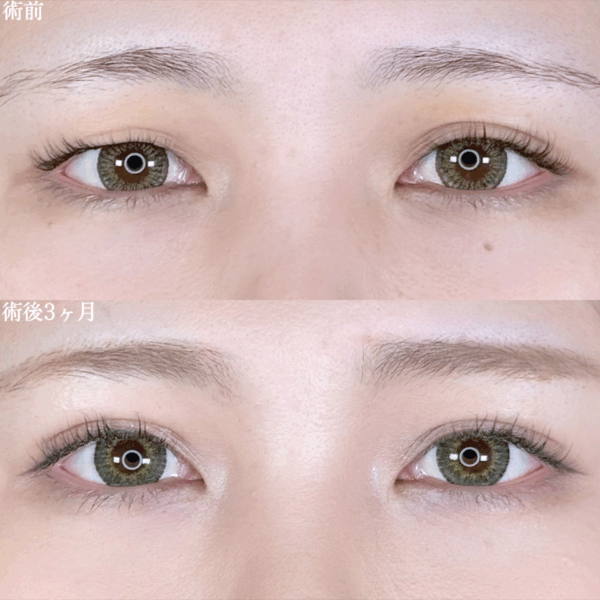 No.9877の症例写真
