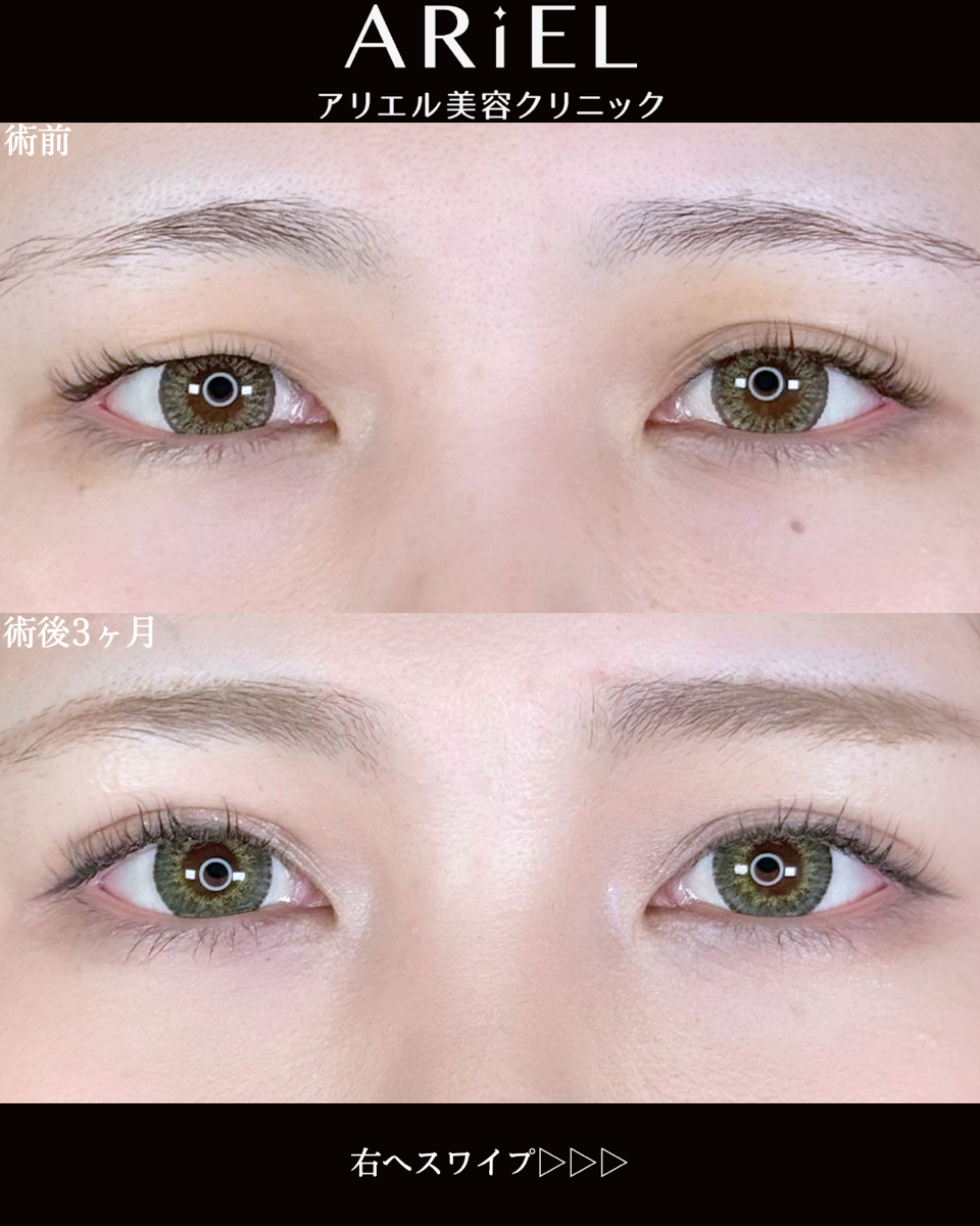 No.9877の症例写真 No.9877の症例写真